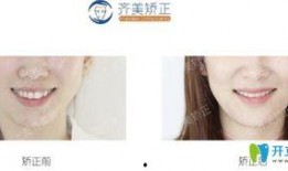 齐美口腔爆料视频大全,揭秘口腔护理那些事